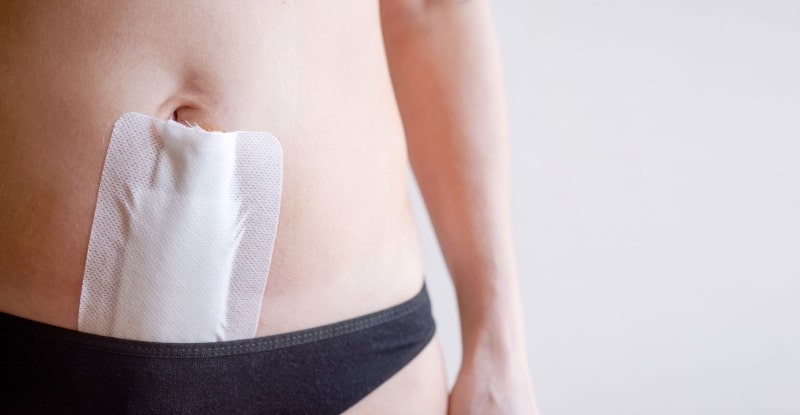 Woman with abdominal heat patch illustrating mild uterine fibroid symptoms managed without treatment.